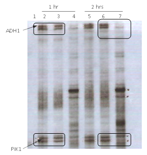 **Figura 4.19. Patrón de bandas representativas del despliegue diferencial.<br/>  Los carriles 2 y 5 representan el control negativo (levadura tratada con <br/>alcohol al 70 %), al compararlos con los carriles 3 y 6 con 1 hora <br/>postratamiento; y, 4 y 7 a dos horas del tratamiento con EEP, este último <br/>a una dosis de 0.6 mg/mL. Se evidencia la pobre expresión de los genes<br/> ADH1 y PIK1**[^96^]