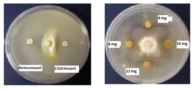 **Figura 4.21. Prueba de inhibición de crecimiento radial <br/>de _Microsporum canis_, donde se observan halos de inhibición<br/> con discos impregnados con EEP a 4, 8, 12, 16 mg/mL. <br/>Los resultados fueron comparados con los halos producidos <br/>por Ketoconazol y Clotrimazol**