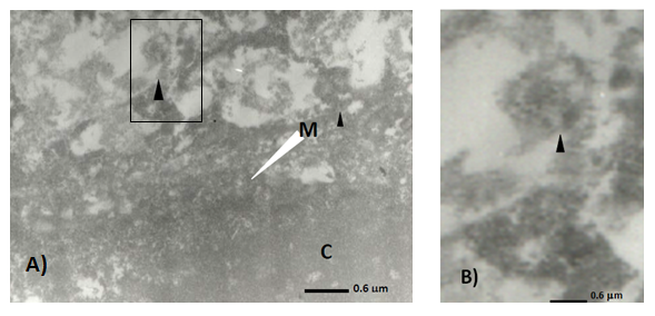 **Figura 4.24. Células tratadas con propóleo (0.5 mg/mL) dos horas antes de la infección con Aujeszky. A. partículas virales (<U+25B2>) en el citoplasma de la célula (C), también se observó una estructura densa y grumosa ubicada en la membrana celular (M) en la que las partículas virales quedan atrapadas. B. Micrografía amplificada de la figura A en la que se observa posible deterioro en la superficie de una partícula viral de Aujeszky ubicada fuera de la membrana plasmática de la célula infectada**